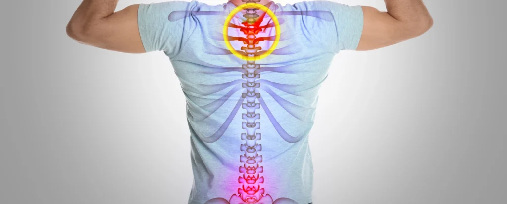 Queen Creek Arizona Chiropractic Natural Headache Treatments